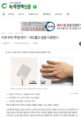 녹색경제신문: 피부 부착 ‘투명 패치’…여드름과 염증 치료한다