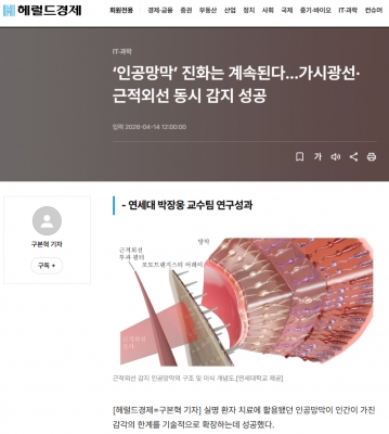 [헤럴드경제] ‘인공망막’ 진화는 계속된다…가시광선·근적외선 동시 감지 성공