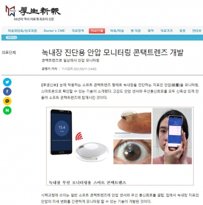후생신보: 녹내장 진단용 안압 모니터링 콘택트렌즈 개발