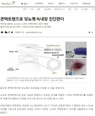 헬로디디: 콘택트렌즈로 당뇨병, 녹내장 진단한다