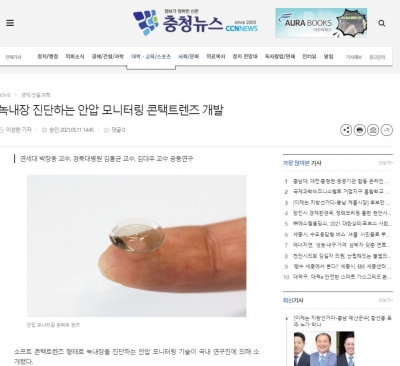 충청뉴스: 녹내장 진단하는 안압 모니터링 콘택트렌즈 개발
