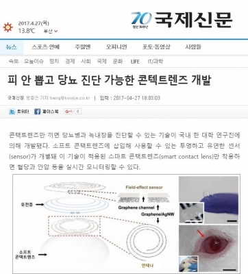 국제신문: 피 안 뽑고 당뇨 진단 가능한 콘택트렌즈 개발