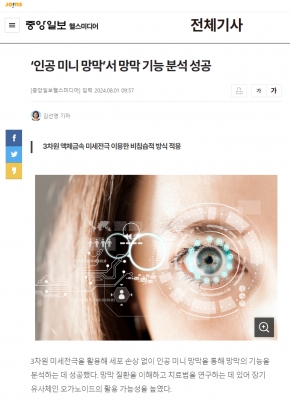 ‘인공 미니 망막’서 망막 기능 분석 성공