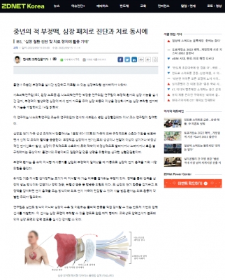 ZDNET Korea: 중년의 적 부정맥, 심장 패치로 진단과 치료 동시에