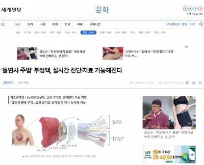 세계일보: '돌연사 주범' 부정맥, 실시간 진단 치료 가능해진다
