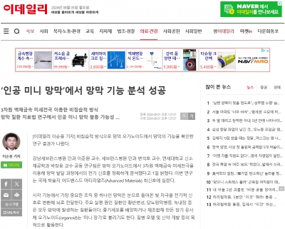 ‘인공 미니 망막’에서 망막 기능 분석 성공