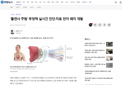 연합뉴스: '돌연사 주범' 부정맥 실시간 진단·치료 전자 패치 개발