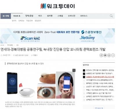 워크투데이: 연세대-경북대병원 공동연구팀, 녹내장 진단용 안압 모니터링 콘택트렌즈 개발
