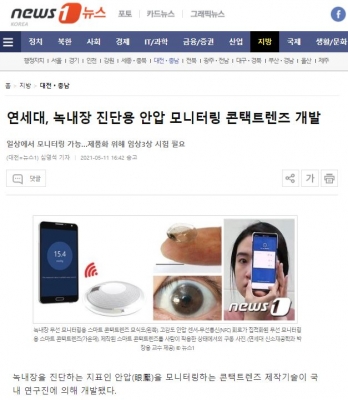 뉴스1: 연세대, 녹내장 진단용 안압 모니터링 콘택트렌즈 개발