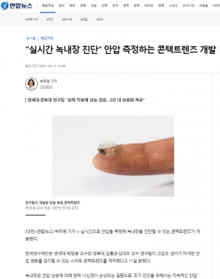연합뉴스: '실시간 녹내장 진단' 안압 측정하는 콘택트렌즈 개발