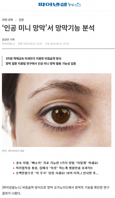 ‘인공 미니 망막’서 망막기능 분석