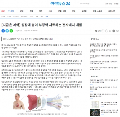아이뉴스24: [지금은 과학] 심장에 붙여 부정맥 치료하는 전자패치 개발