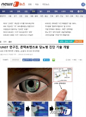 NEWS1: UNIST 연구진, 콘택트렌즈로 당뇨병 진단 기술 개발