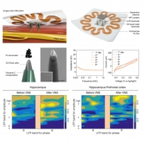 [2026] Wireless, Skin-Attachable Patch with 3D Liquid Metal Electrodes for Vagus Nerve Stimulation in Depression